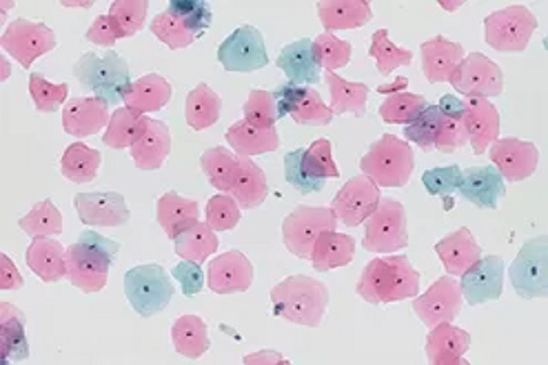Liquid Based Cytology Technique: Technological Innovations and Applications