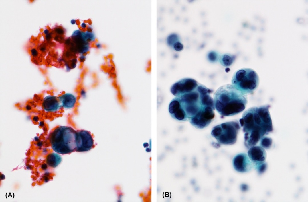 /uploads/image/2026/04/14/healthsky-liquid-based-cytology-1.jpg healthsky-liquid-based-cytology-1.jpg