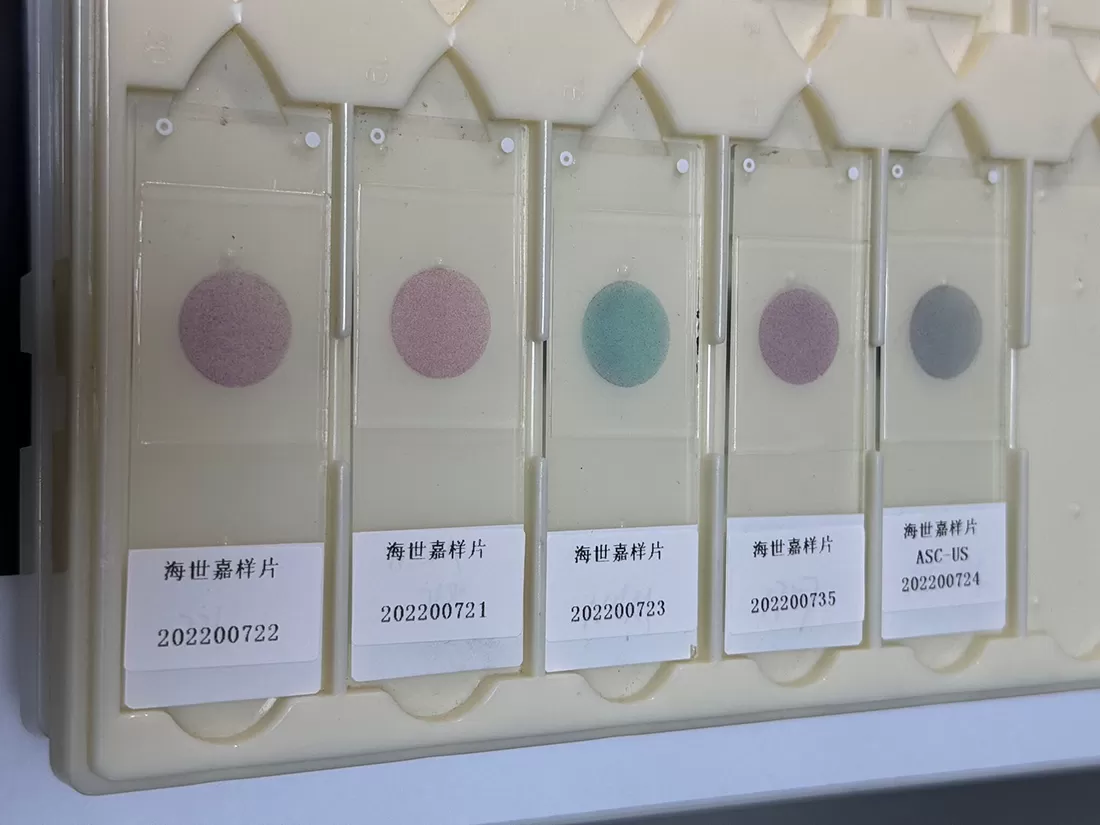 How to Interpret Pap Stain Results Correctly