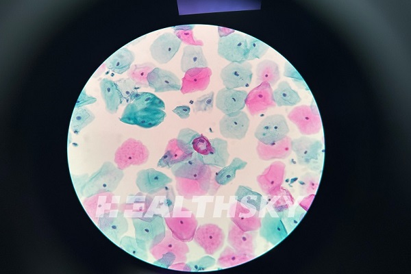 Liquid Based Cytology LBC