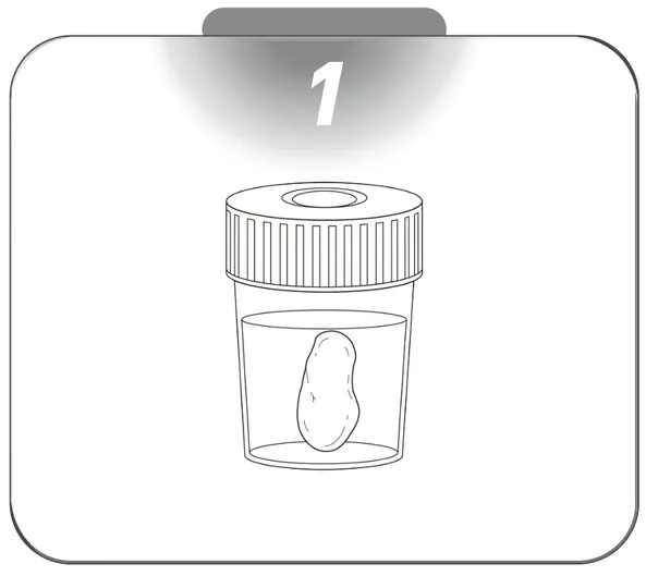 conventional1