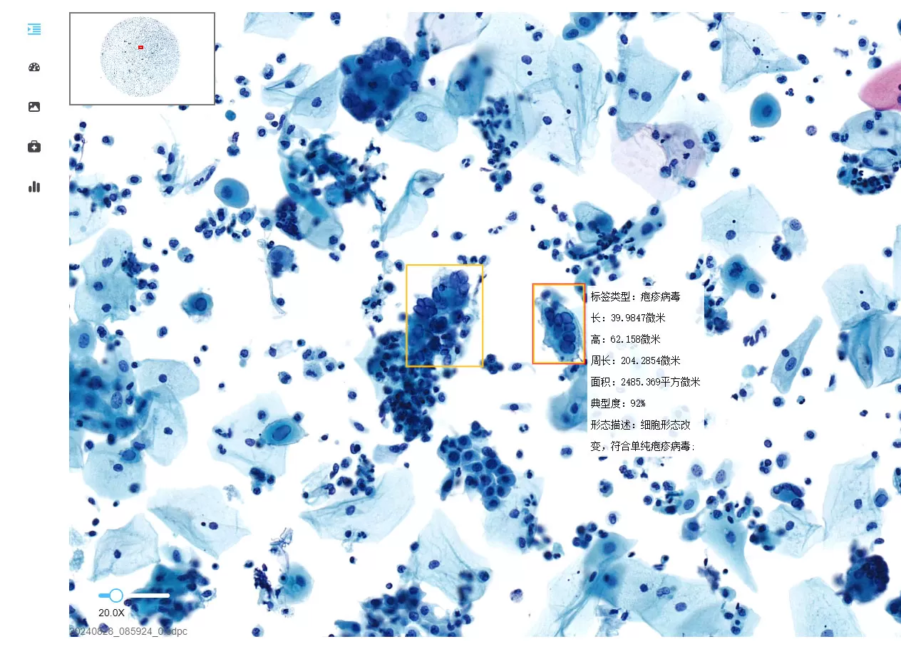 Herpes-Simplex-Virus.jpg Herpes-Simplex-Virus.jpg
