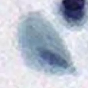 Trichomonas vaginalis