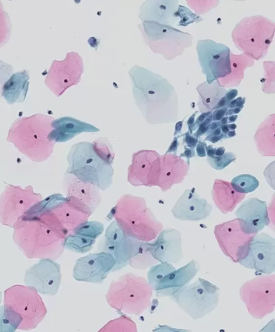 liquid-based-cytology-technique.jpg